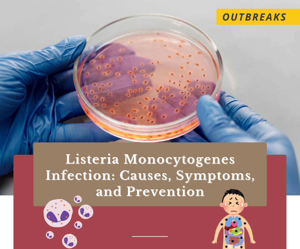 Listeria Monocytogenes Infection: Causes, Symptoms, and Prevention