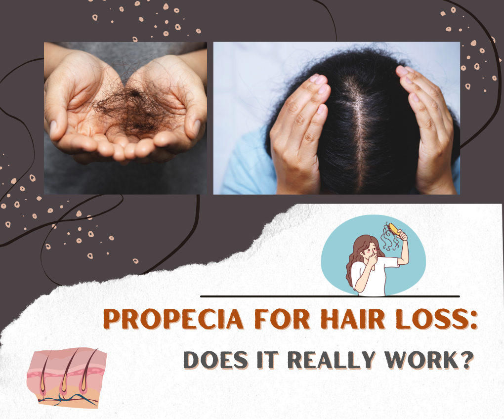 Propecia for Hair Loss: Does It Really Work?